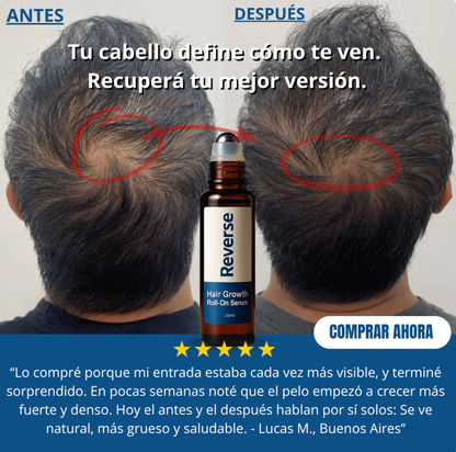 Serum Roll-On para el Crecimiento Capilar - Reverse