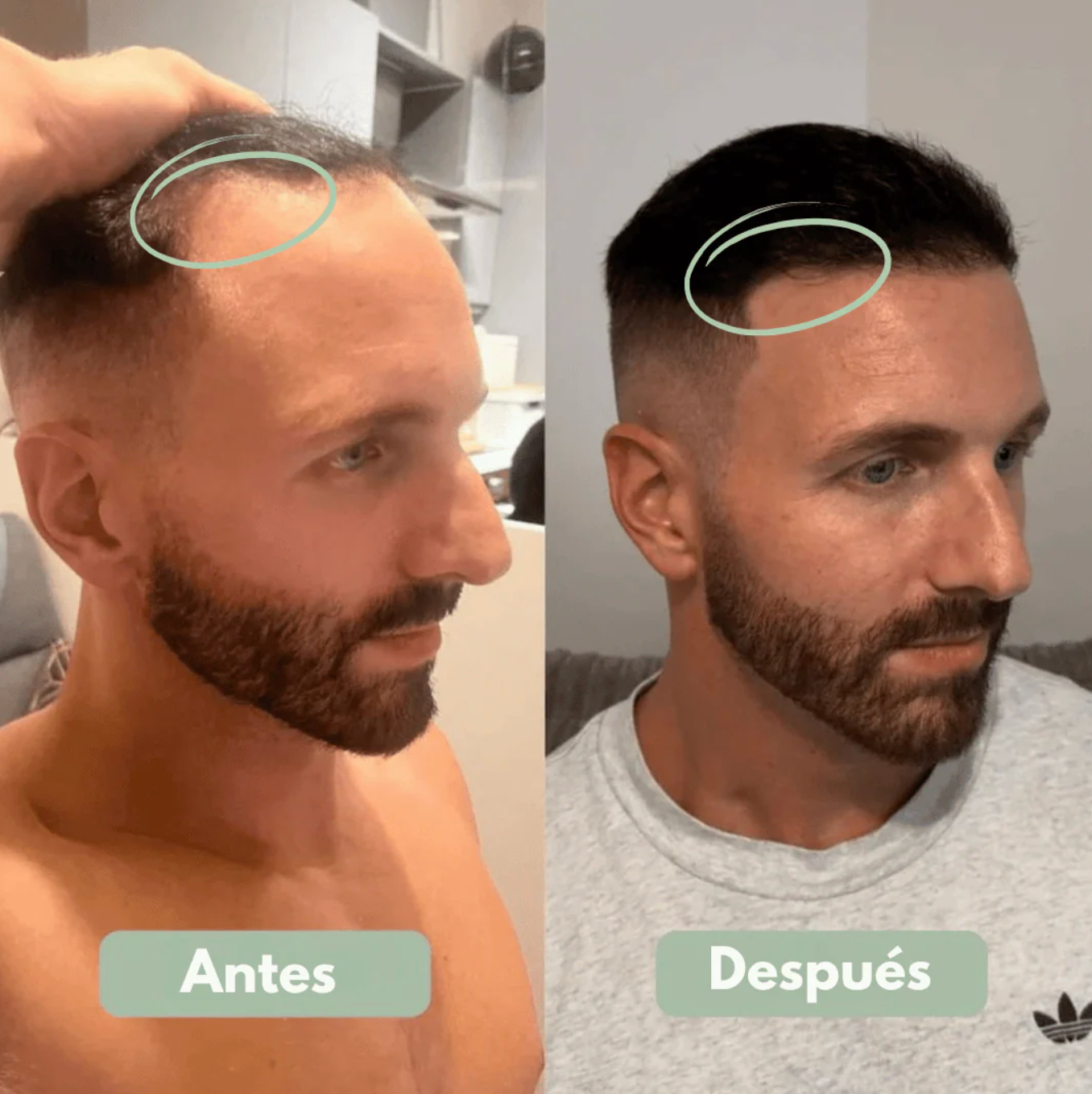 Serum Roll-On para el Crecimiento Capilar - Reverse