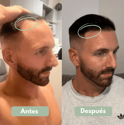 Serum Roll-On para el Crecimiento Capilar - Reverse